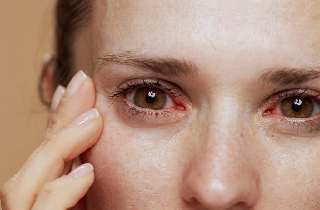 A person with irritated and watery eyes.